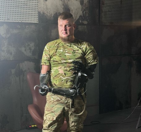 Від перших кроків до бігу – як Герой України з позивним "Гонсалес" відновився після двох ампутацій
