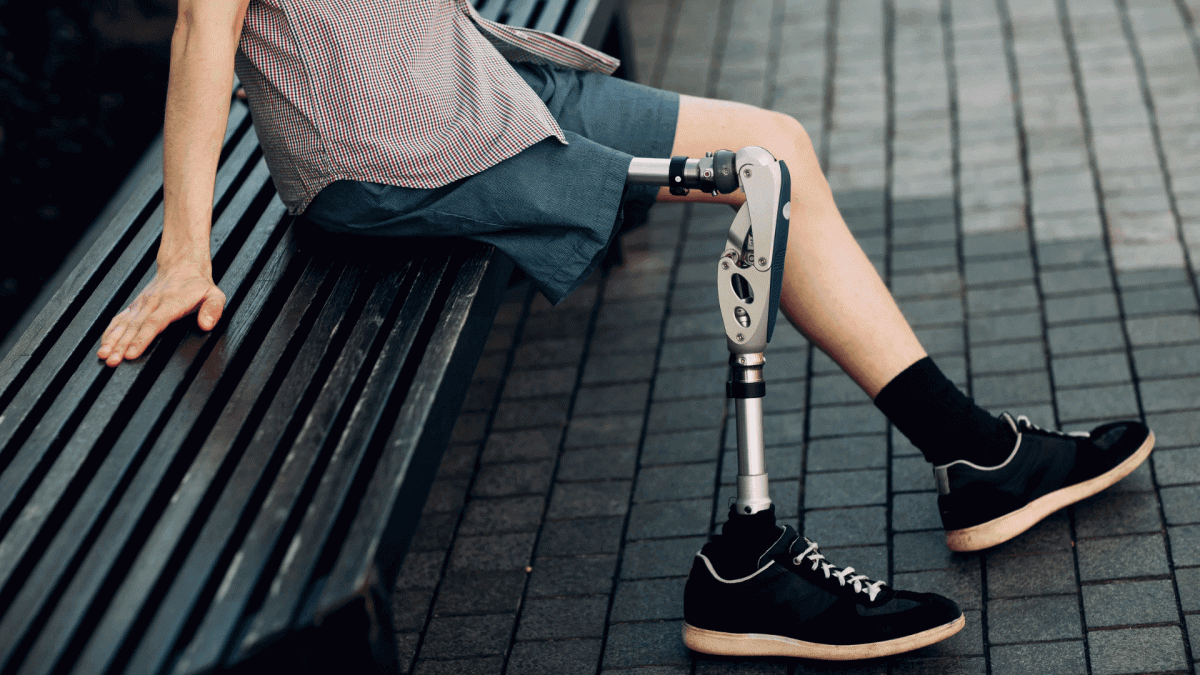 Як часто потрібно змінювати протези – поради українських спеціалістів