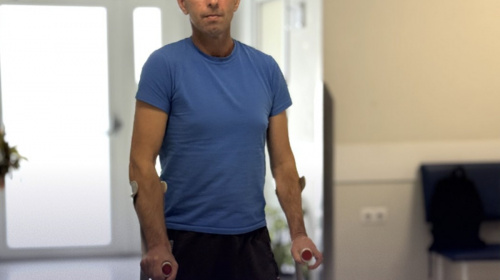 Ногу розтрощило скидом з дрона: на Львівщині рятують кінцівку захисника Андрія Балуха