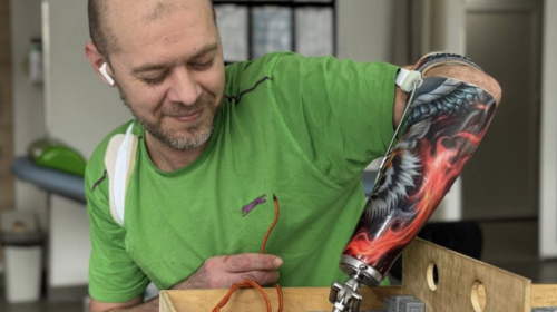 "Хочу навчитися писати біонічною рукою": ветеран Сергій Данов опановує протез після втрати кисті