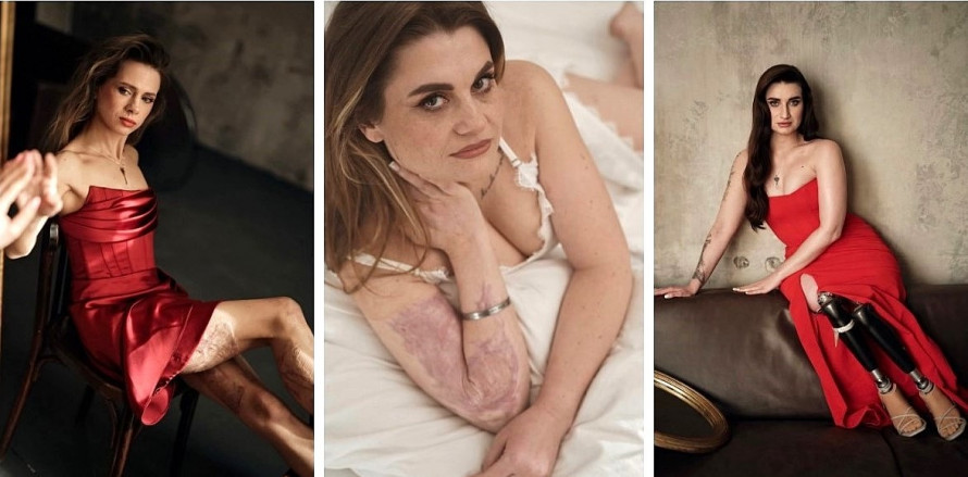 Ветеранки зі шрамами та протезами на обкладинці Playboy: як змінилося життя героїнь, які зруйнували стереотипи про жіночу красу